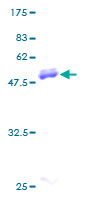 12.5% SDS-PAGE Stained with Coomassie Blue.
